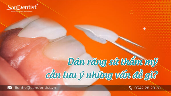 Dán răng sứ thẩm mỹ cần lưu ý những vấn đề gì?