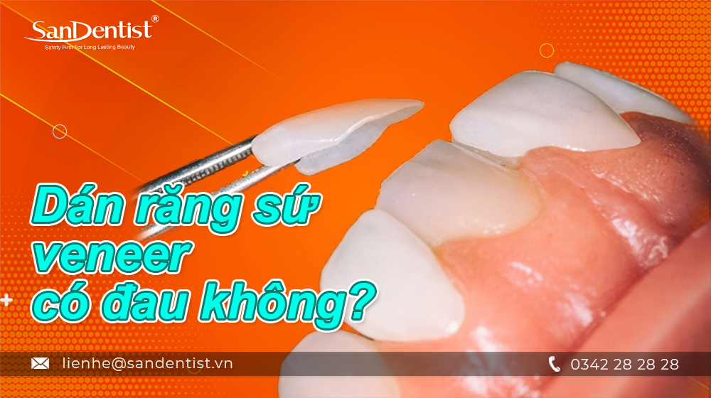 Dán răng sứ veneer có đau không?
