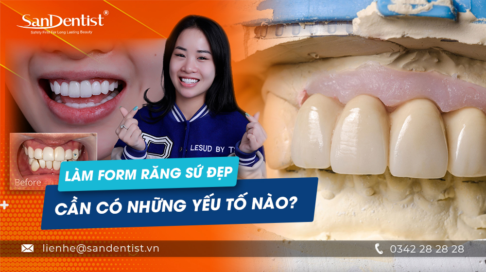 Làm form răng sứ đẹp cần có những yếu tố nào?
