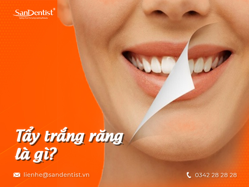 Răng sứ có tẩy trắng được không? Bảo vệ răng sứ thế nào?