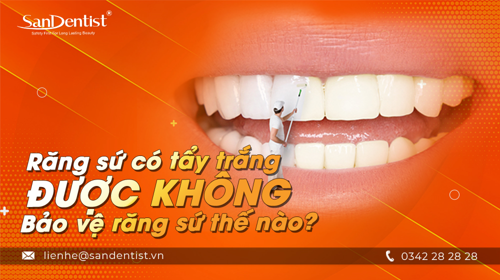 Răng sứ có tẩy trắng được không? Bảo vệ răng sứ thế nào?