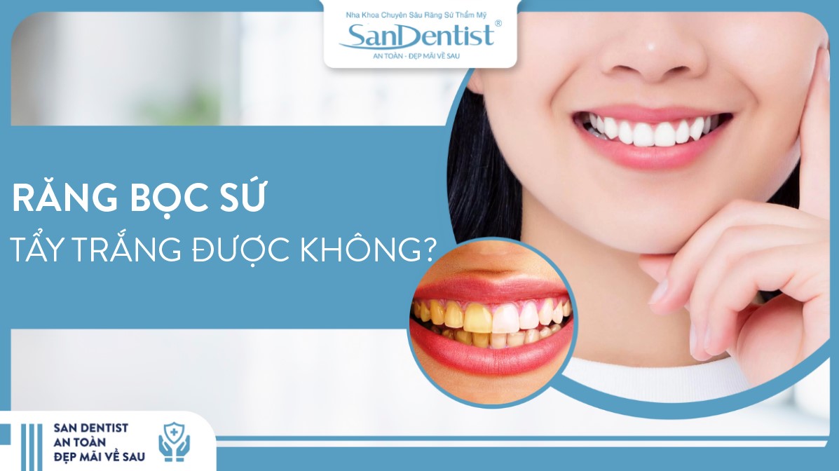 Răng sứ có tẩy trắng được không