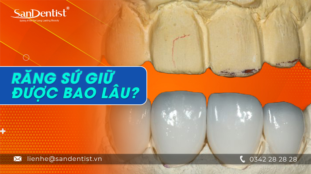 Răng sứ giữ được bao lâu?