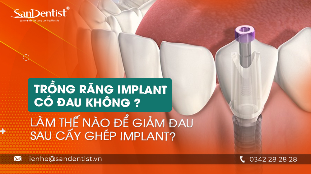 Trồng răng implant có đau không? Làm thế nào để giảm đau sau cấy ghép implant?