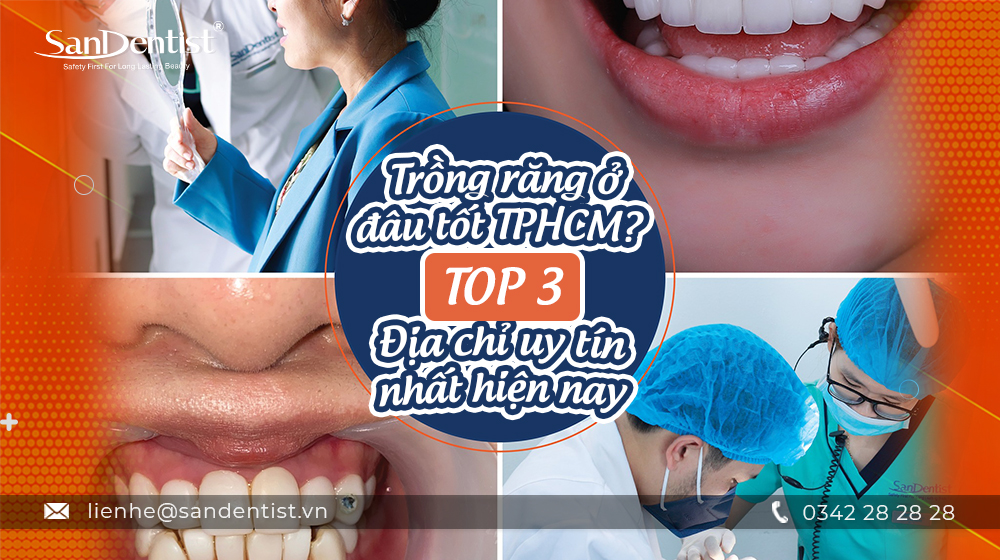 Trồng răng ở đâu tốt TPHCM? TOP 3 địa chỉ uy tín nhất hiện nay