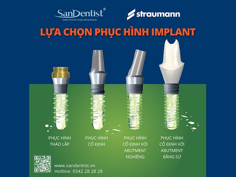 Vì sao trụ Implant Straumann Thụy Sĩ được đánh giá cao?
