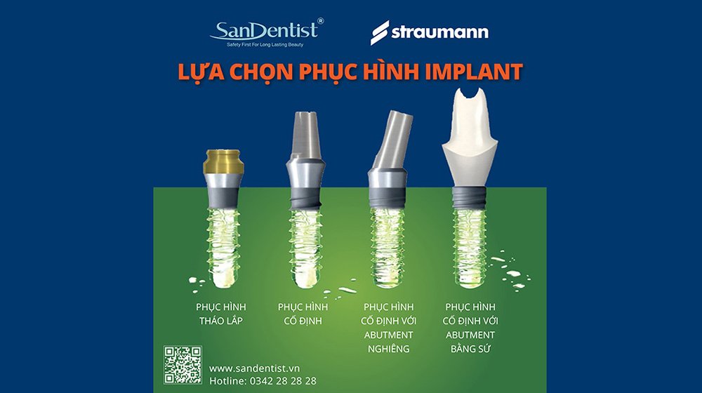 Vì sao trụ Implant Straumann Thụy Sĩ được đánh giá cao?