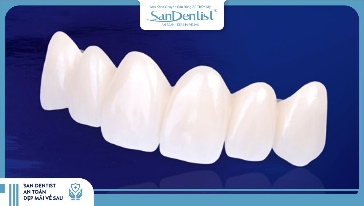 Răng sứ là gì? 2 loại răng sứ kim loại và toàn sứ phổ biến trên thị trường hiện nay