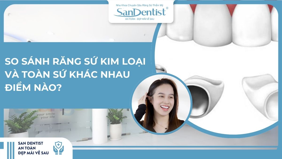 So sánh răng sứ kim loại và toàn sứ khác nhau điểm nào
