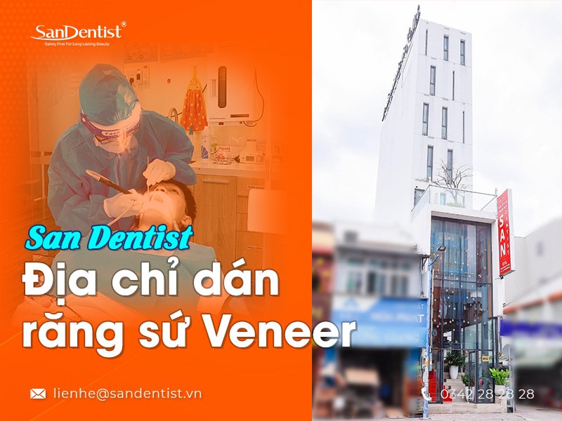 Dán răng sứ Veneer và những điều cần lưu ý