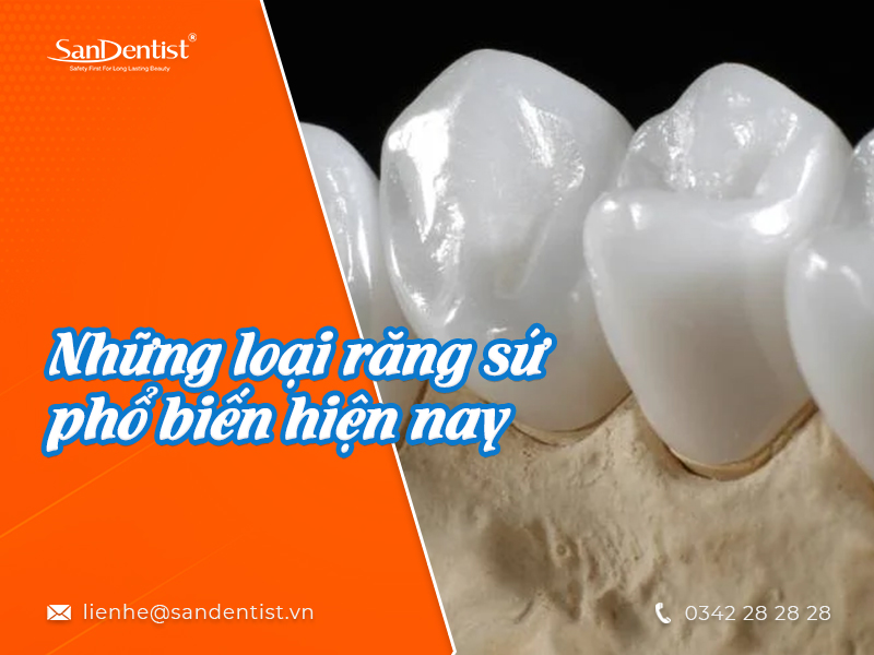 Nên làm răng sứ loại nào an toàn và chất lượng?