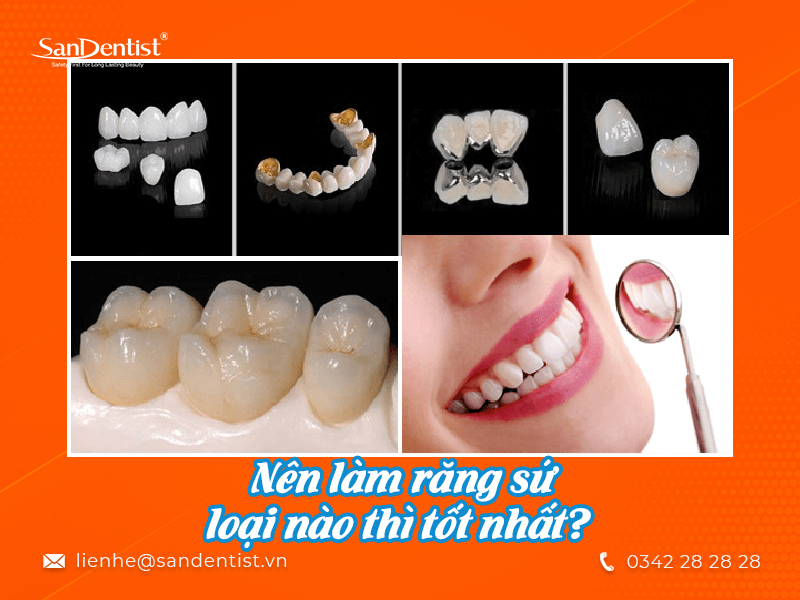 Nên làm răng sứ loại nào an toàn và chất lượng?