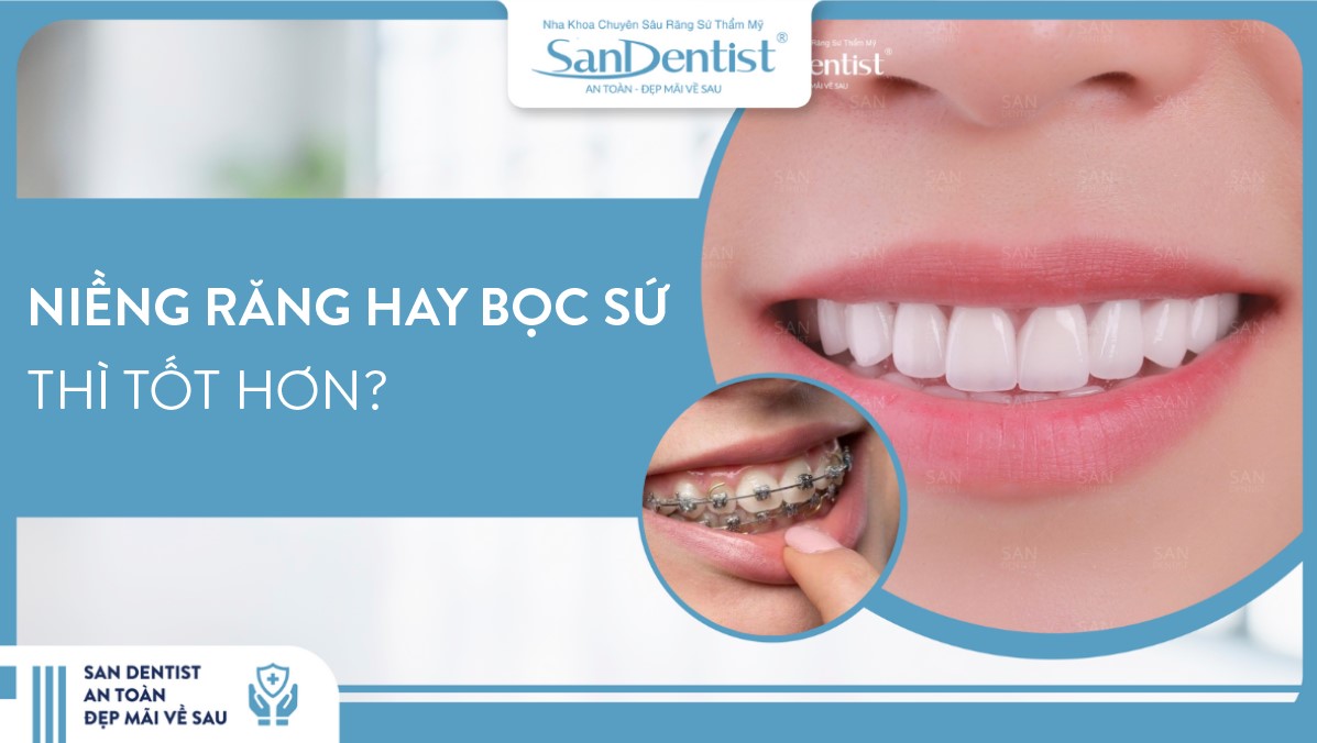 Nên niềng răng hay bọc sứ