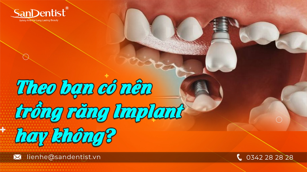 Theo bạn có nên trồng răng Implant hay không?