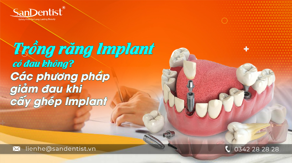 Trồng răng Implant có đau không? Các phương pháp giảm đau khi cấy ghép Implant