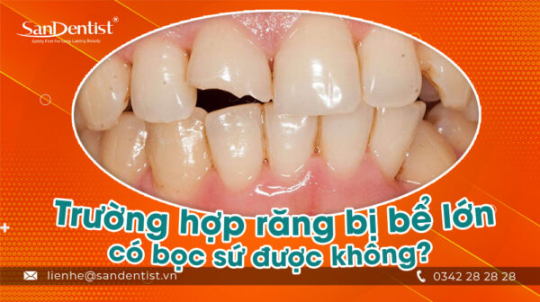 Trường hợp răng bị bể lớn có bọc sứ được không?