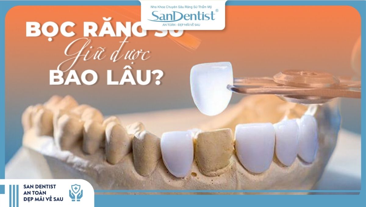 Bọc răng sứ được bao lâu