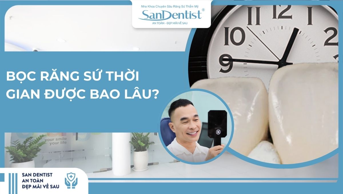 Bọc răng sứ thời gian được bao lâu