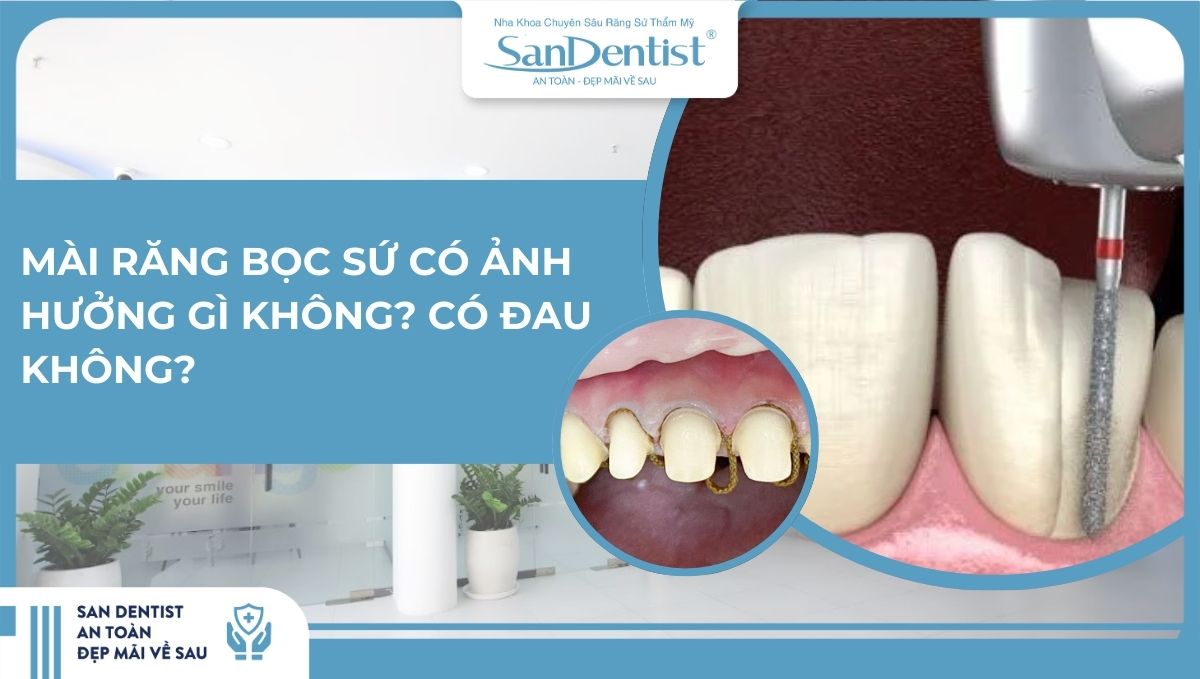 Mài răng bọc sứ có ảnh hưởng gì không_ Có đau không