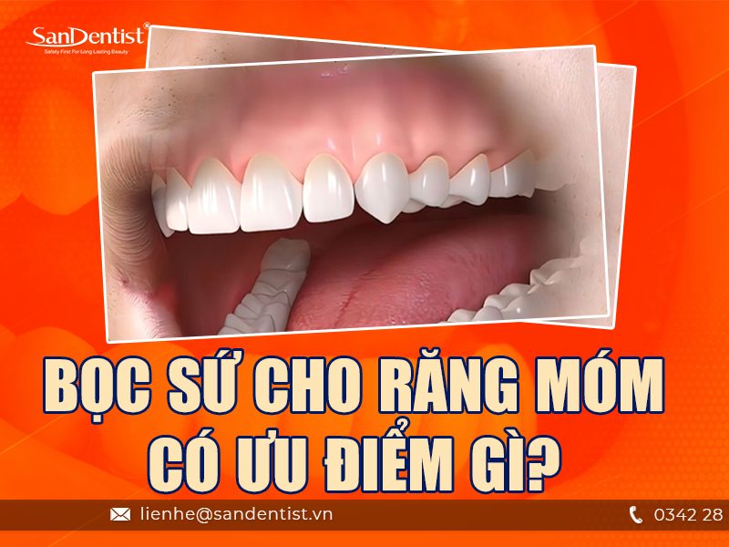 Bọc răng sứ có hết móm không? Cách điều trị hiệu quả