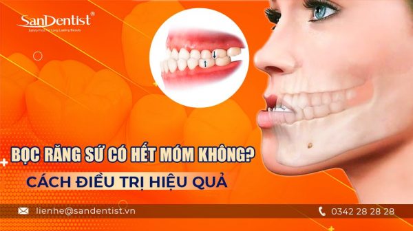 Bọc răng sứ có hết móm không? Cách điều trị hiệu quả