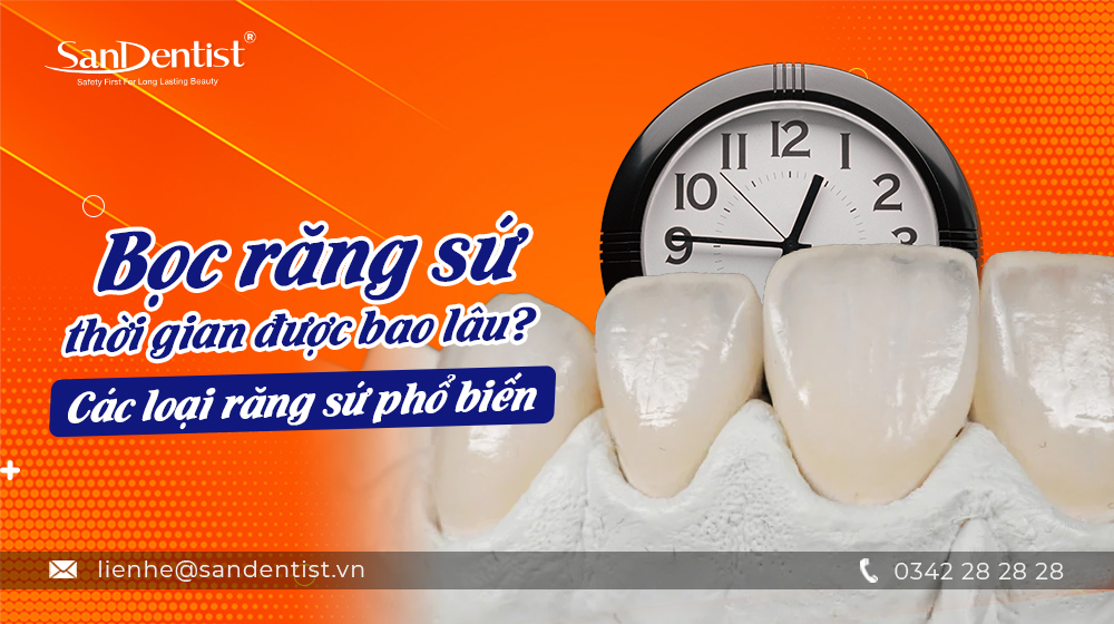 Bọc răng sứ thời gian được bao lâu? Các loại răng sứ phổ biến