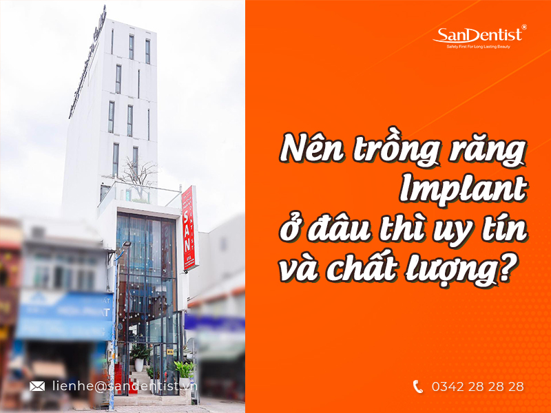 Cắm Implant ở đâu tốt? 5 tiêu chí lựa chọn địa chỉ làm răng Implant uy tín 