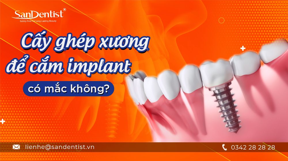 Cấy ghép xương để cắm Implant có mắc không?