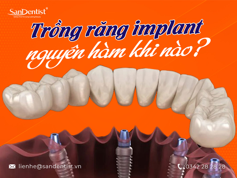 5 lý do nên trồng răng implant nguyên hàm