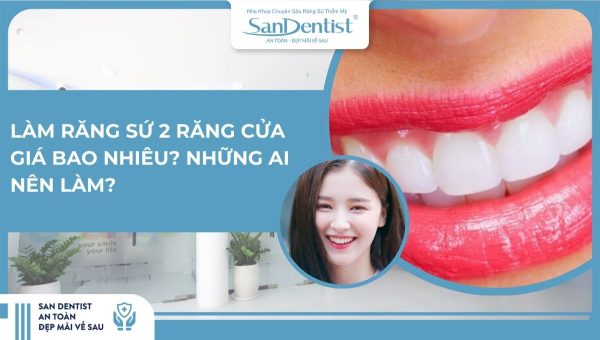 Làm răng sứ 2 răng cửa giá bao nhiêu_ Những ai nên làm