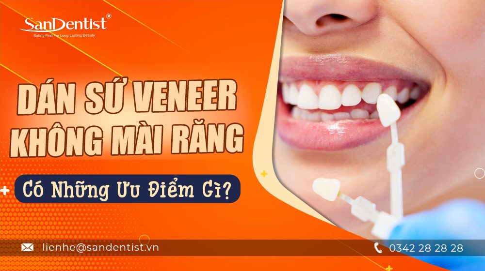 Dán sứ veneer không mài răng có những ưu điểm gì?