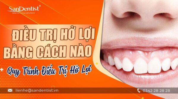 Điều trị hở lợi bằng cách nào và quy trình điều trị hở lợi