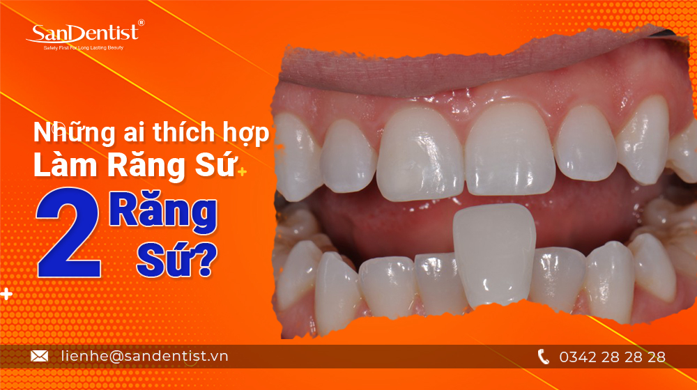 Những ai thích hợp làm răng sứ 2 răng cửa?