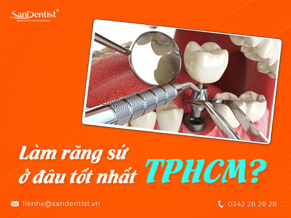 Những tiêu chí đánh giá địa chỉ làm răng sứ ở đâu tốt nhất TPHCM?