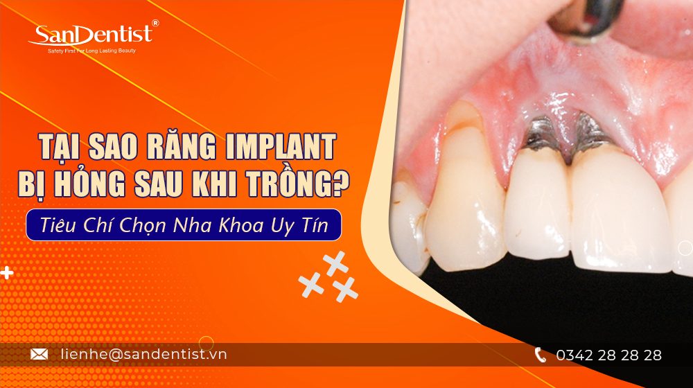 Tại sao răng implant bị hỏng sau khi trồng ? Tiêu chí chọn nha khoa uy tín