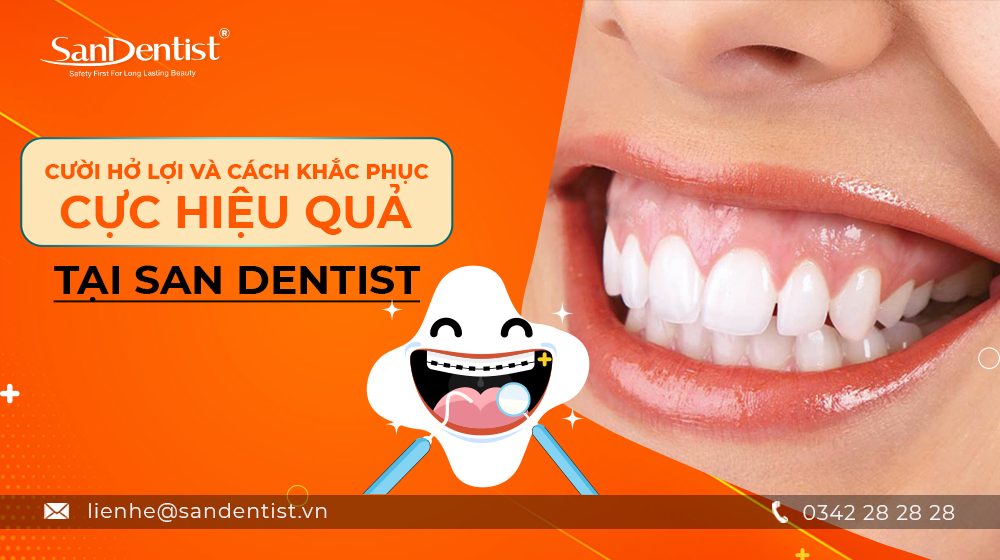 Cười hở lợi và cách khắc phục cực hiệu quả tại San Dentist