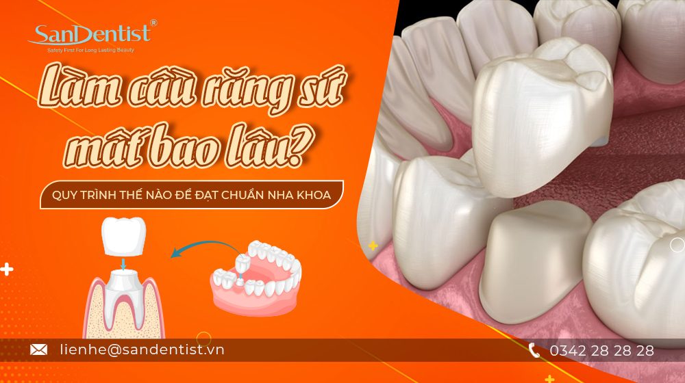 Làm cầu răng sứ mất bao lâu? Quy trình thế nào để đạt chuẩn nha khoa