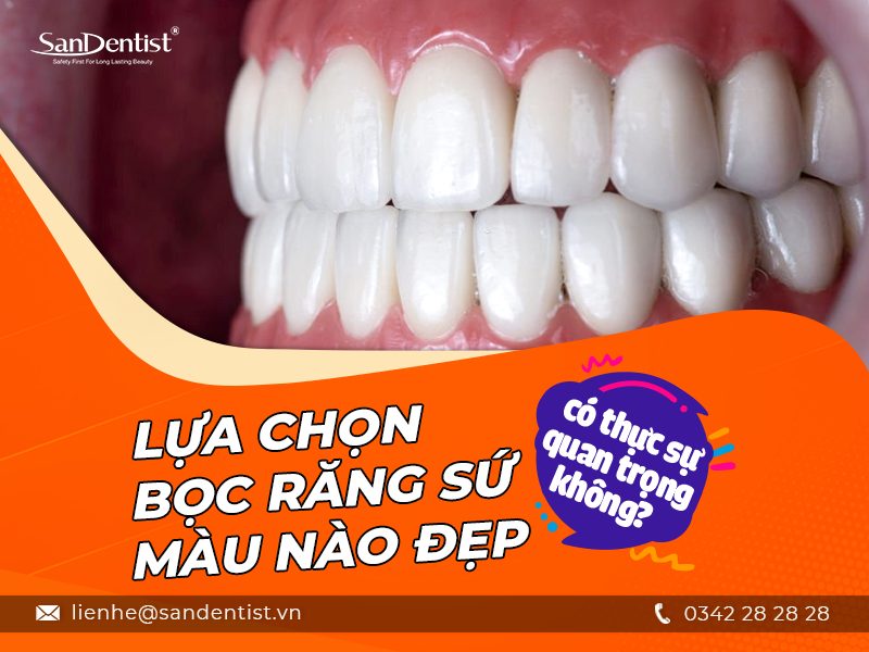 Những cách để chọn bọc răng sứ màu nào đẹp tự nhiên phù hợp với bạn