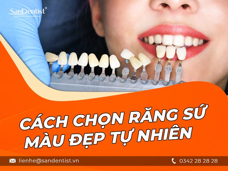 Những cách để chọn bọc răng sứ màu nào đẹp tự nhiên phù hợp với bạn