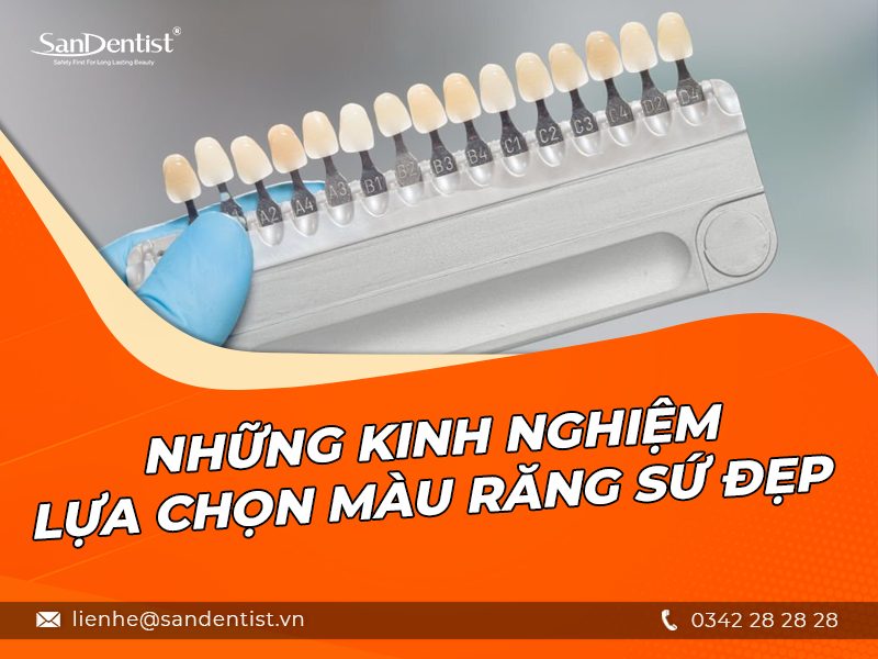 Những cách để chọn bọc răng sứ màu nào đẹp tự nhiên phù hợp với bạn