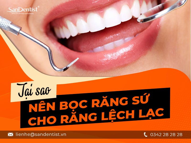 Những thông tin hữu ích về bọc răng sứ cho răng lệch lạc