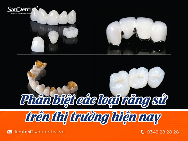 Những ưu nhược điểm bọc răng sứ - Có nên lựa chọn phương pháp bọc răng sứ hay không?