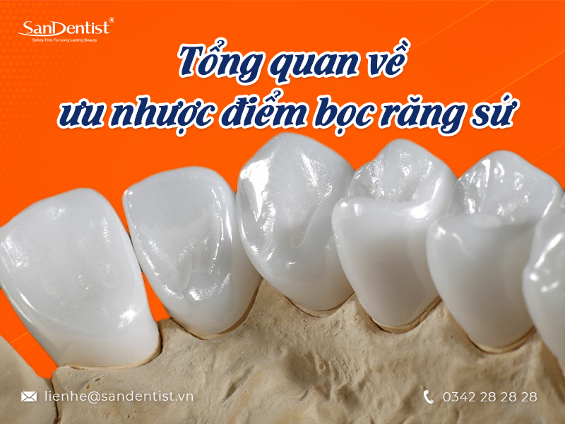 Những ưu nhược điểm bọc răng sứ - Có nên lựa chọn phương pháp bọc răng sứ hay không?