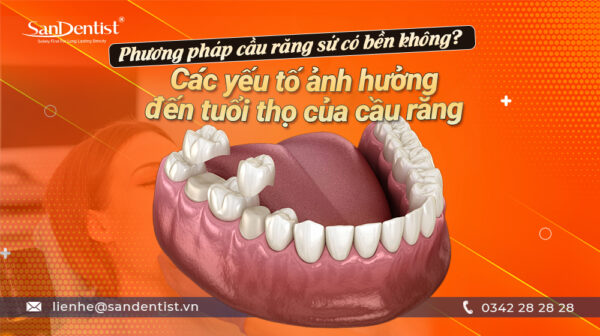 Phương pháp cầu răng sứ có bền không? Các yếu tố ảnh hưởng đến tuổi thọ của cầu răng