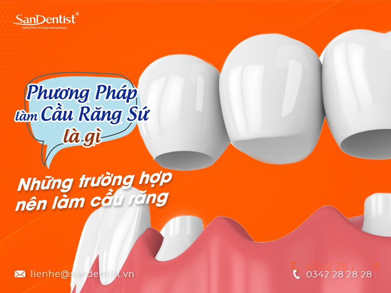 Phương pháp làm cầu răng có đau không? Cách khắc phục như thế nào?