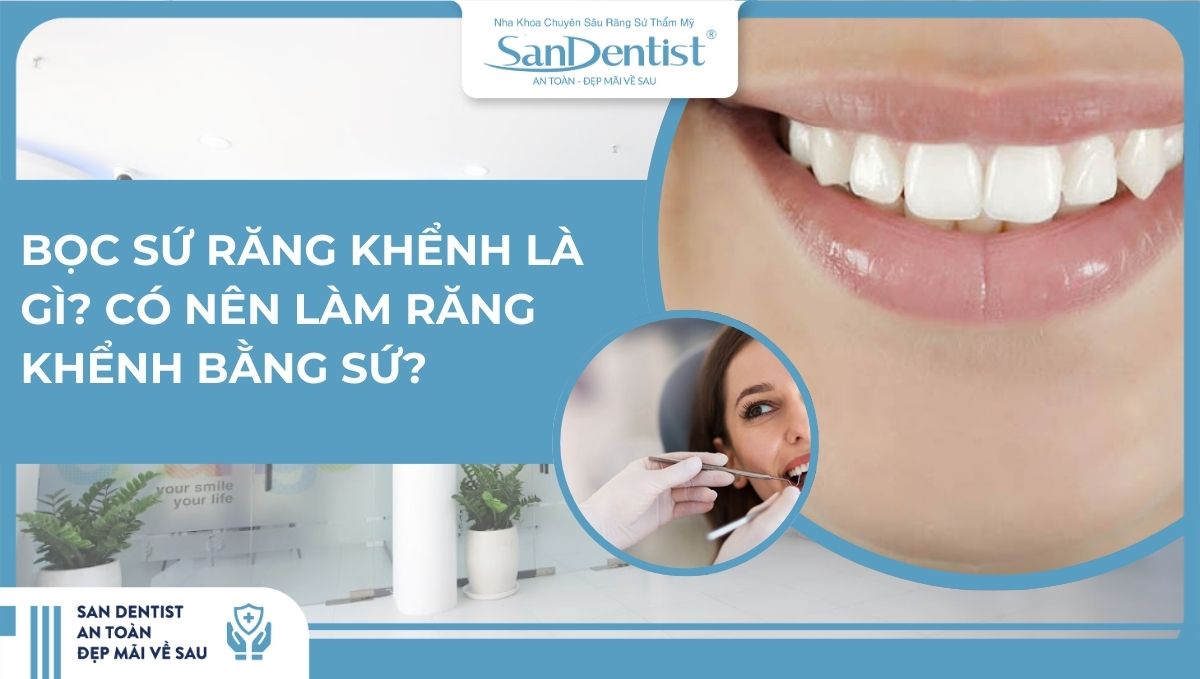 Bọc sứ răng khểnh là gì Có nên làm răng khểnh bằng sứ