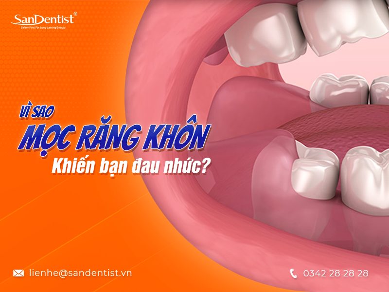 Có nên nhổ răng khôn khi đang bị đau hay không?