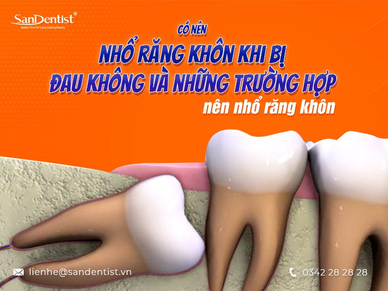 Có nên nhổ răng khôn khi đang bị đau hay không?