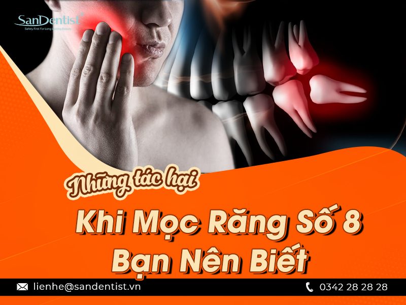 Có nên nhổ răng số 8 hàm dưới không? Cần lưu ý gì khi nhổ răng số 8