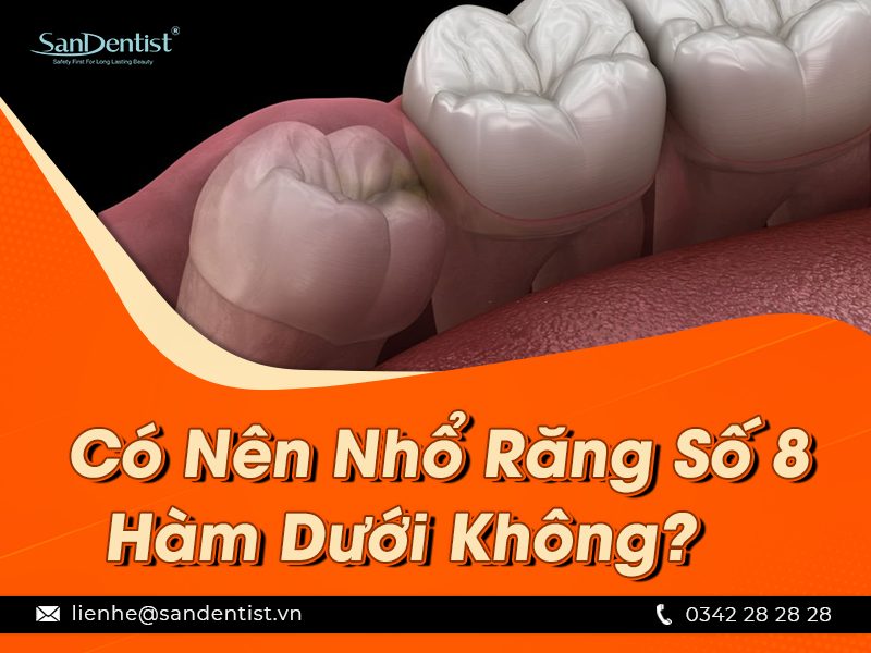 Có nên nhổ răng số 8 hàm dưới không? Cần lưu ý gì khi nhổ răng số 8